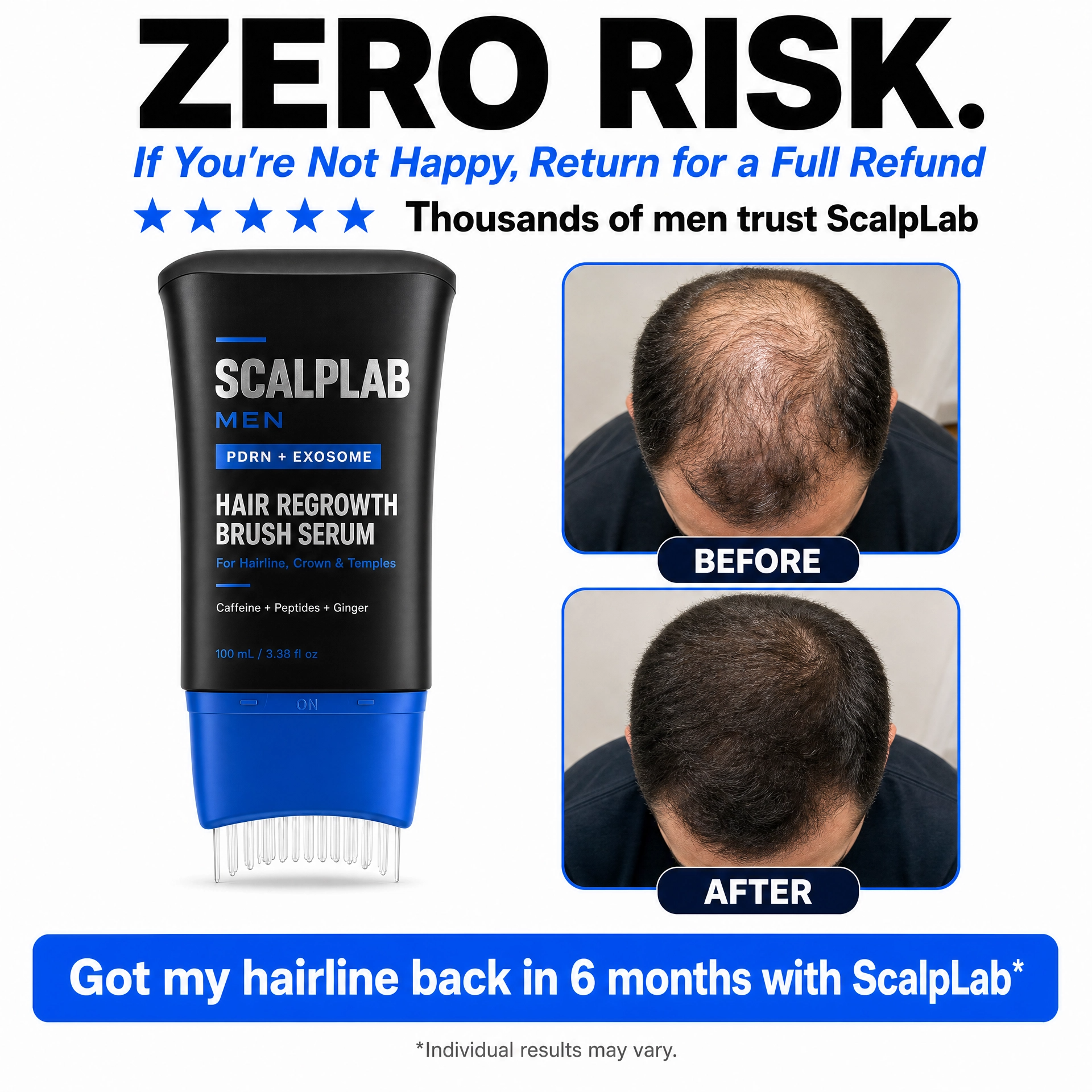 ScalpLab Hair Regrowth Brush Serum