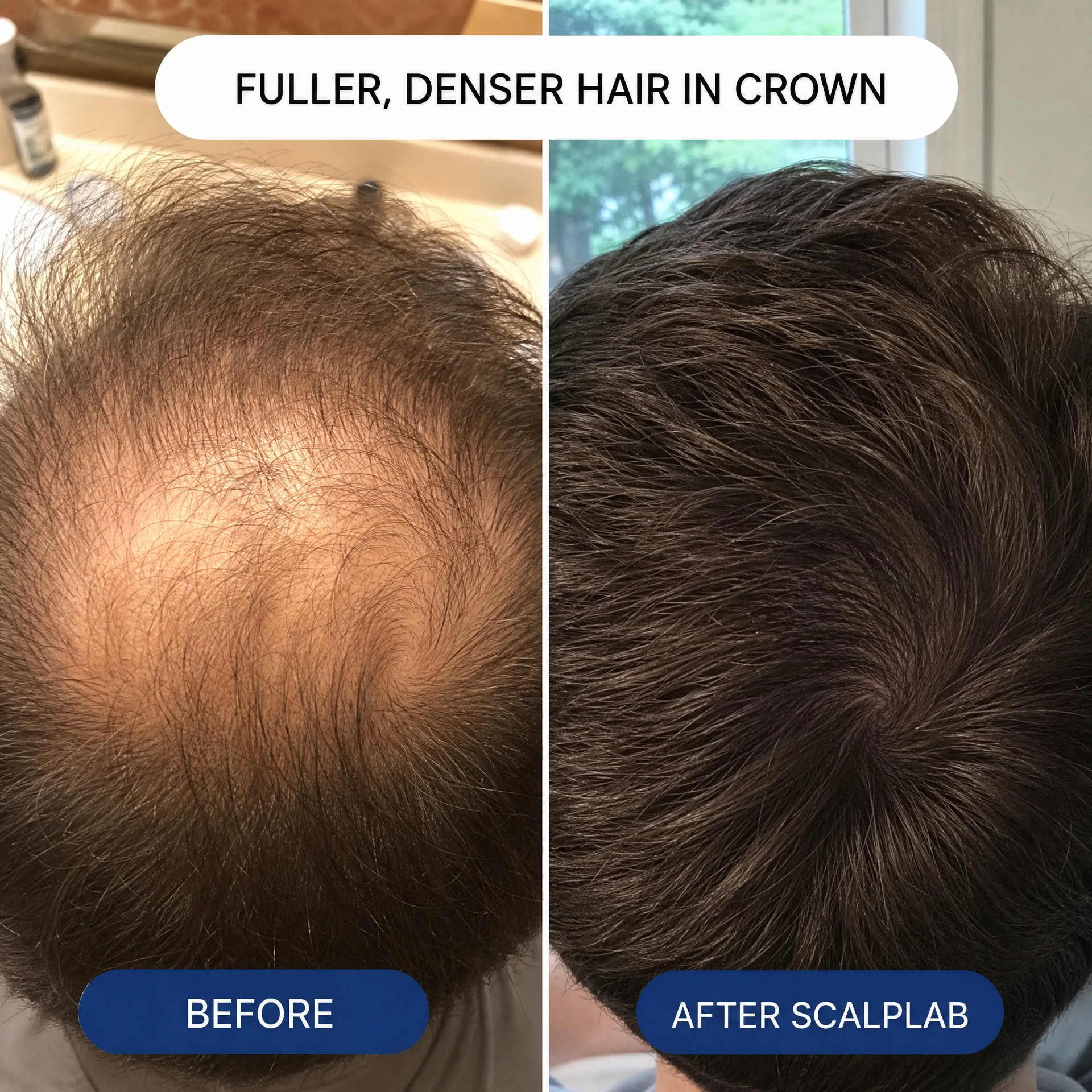 ScalpLab Hair Regrowth Brush Serum