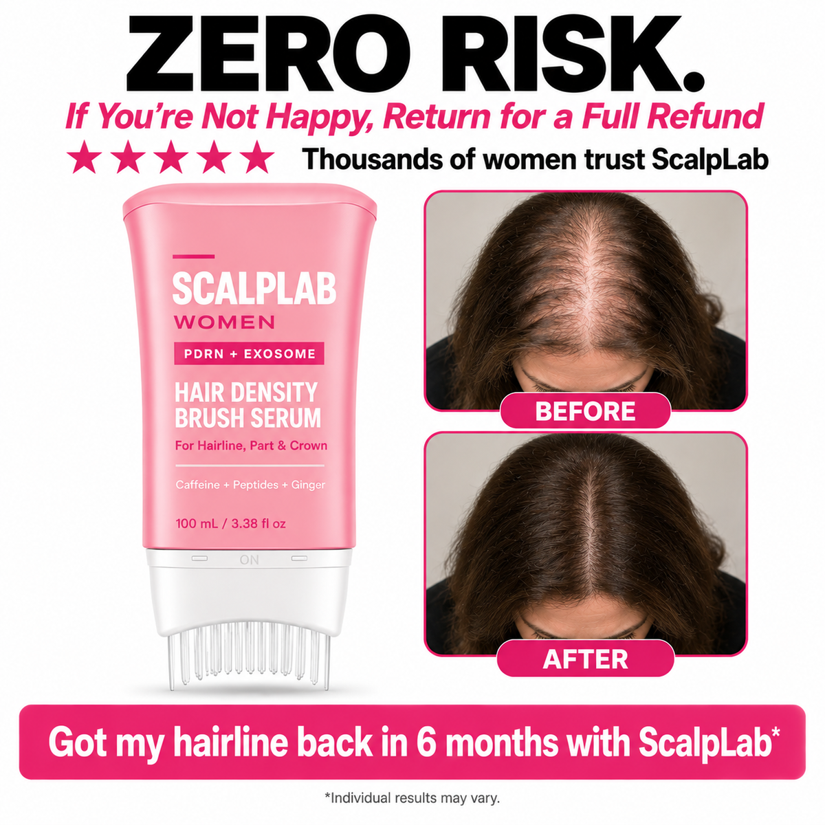 ScalpLab Hair Regrowth Brush Serum