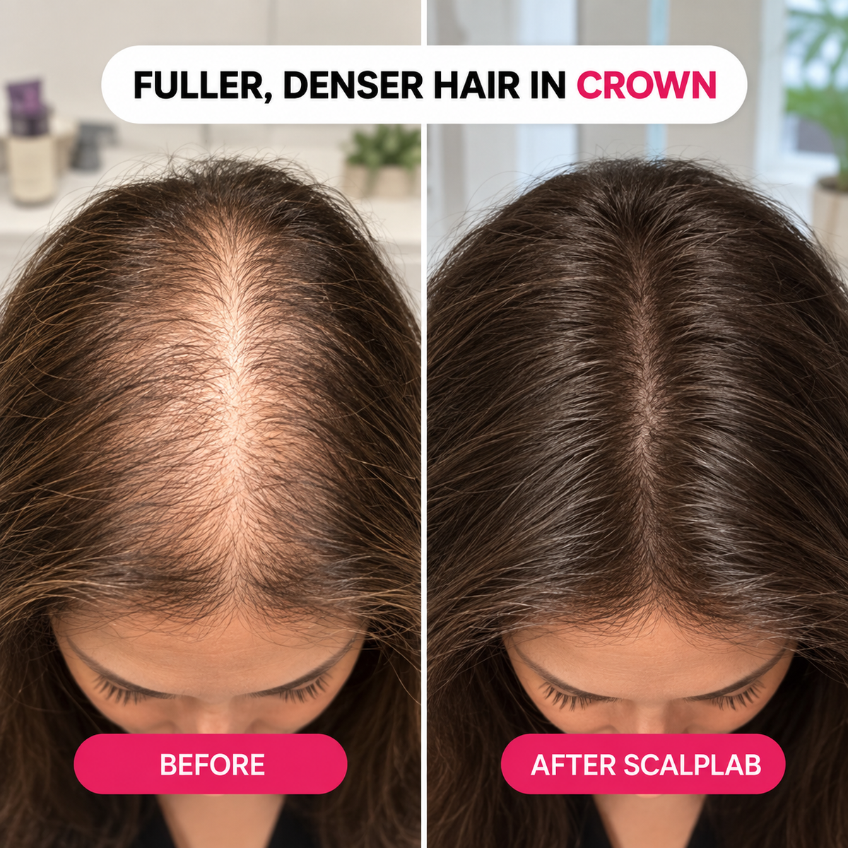 ScalpLab Hair Regrowth Brush Serum